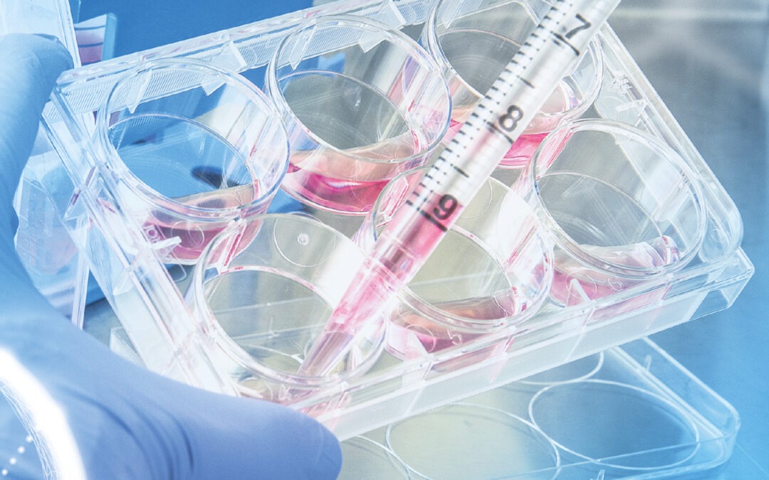 What’s Next for International Clinical Trials? Our CEO and Agile CRO Have the Answers